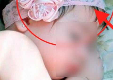 Colocar faixa de cabelo em bebês pode deixar seu filho muito doente, afirma médico