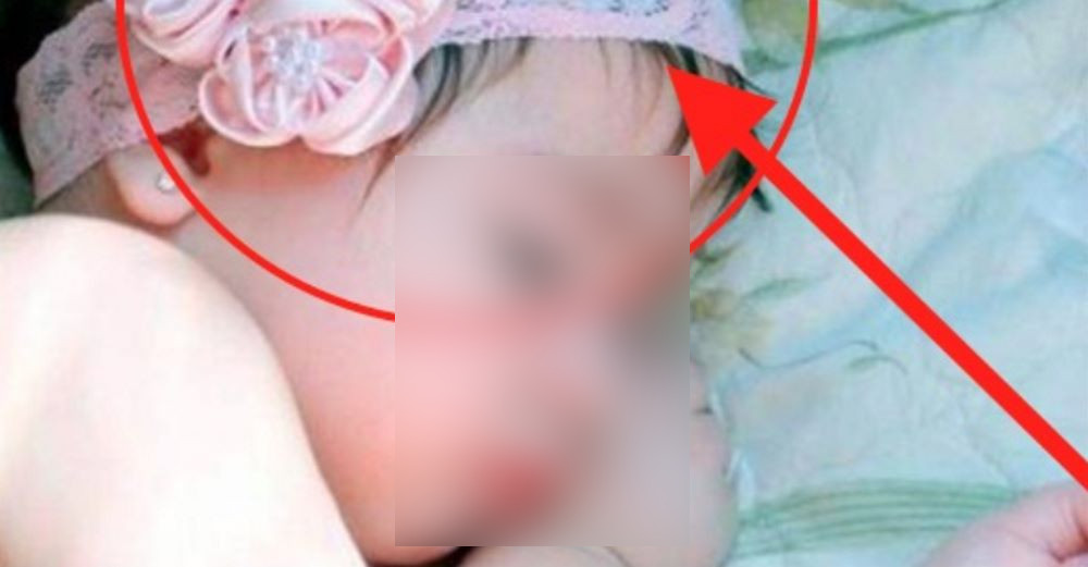 Colocar faixa de cabelo em bebês pode deixar seu filho muito doente, afirma médico