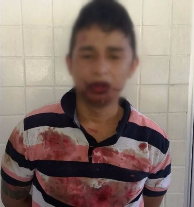 Homem é espancado por populares suspeito de assaltar e fazer idoso refém em Manaus 