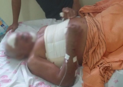 Idoso é brutalmente espancado ao ter casa invadida por assaltantes no Amazonas