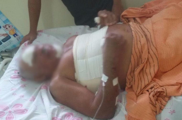 Idoso é brutalmente espancado ao ter casa invadida por assaltantes no Amazonas