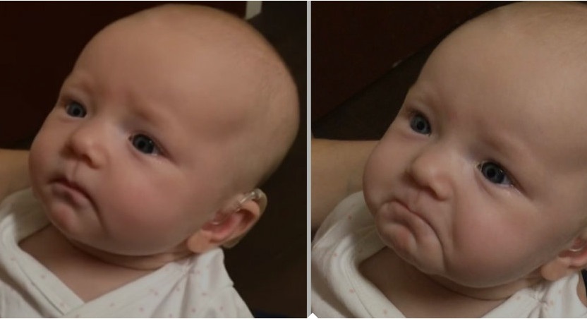 Bebê com problemas auditivos escuta mãe pela primeira vez e se emociona; Vídeo