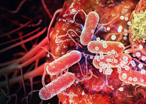 Brasileiro tem conhecimentos falhos sobre o câncer, afirma pesquisa