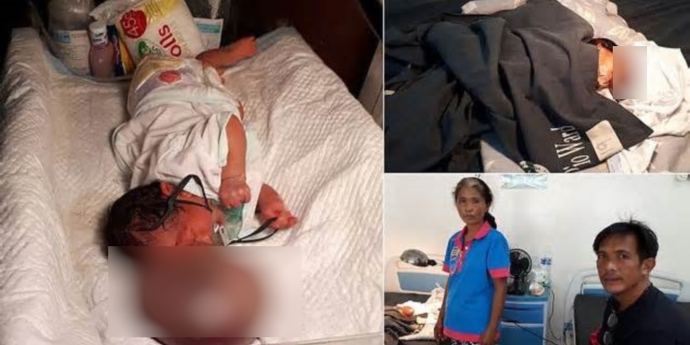 Bebê nasce com bolha gigante no rosto e corre sérios riscos se ela não parar de crescer