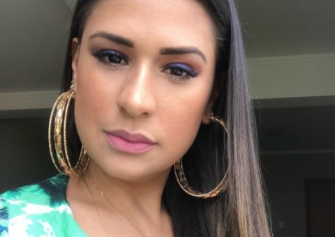  Simone, da dupla com Simaria, aplica botox no rosto e mostra resultado