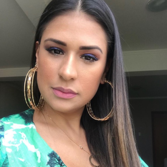  Simone, da dupla com Simaria, aplica botox no rosto e mostra resultado