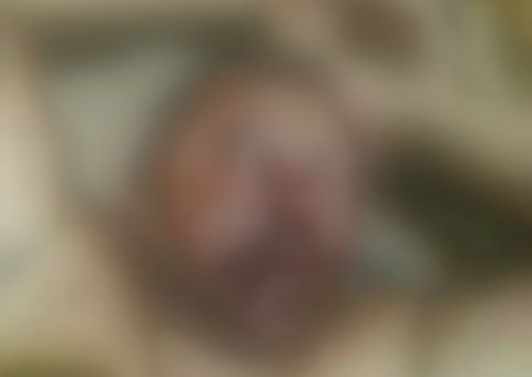 Secretário de esportes do interior do Amazonas tem o rosto desfigurado após espancamento