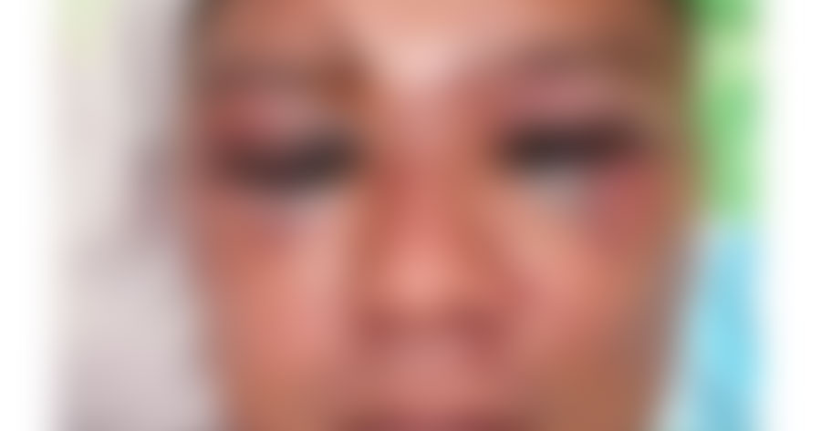 Agente penitenciário tem rosto deformado ao ser espancado por detentos no Ipat em Manaus