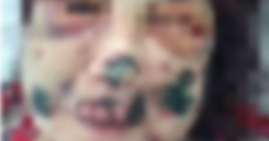 Mulher tem corpo 'rasgado' por suposto canibal que conheceu na internet