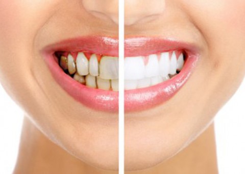 Câmara aprova  projeto que insere Saúde Bucal no SUS