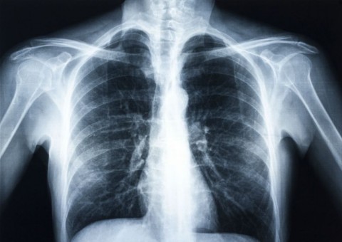 Saiba os sintomas da doença que mais mata crianças menores de 5 anos