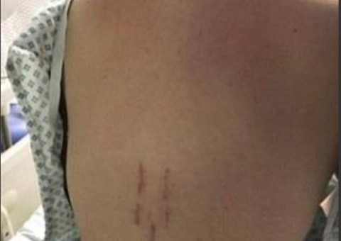 Fanática por malhar fica na cadeira de rodas após acidente na academia