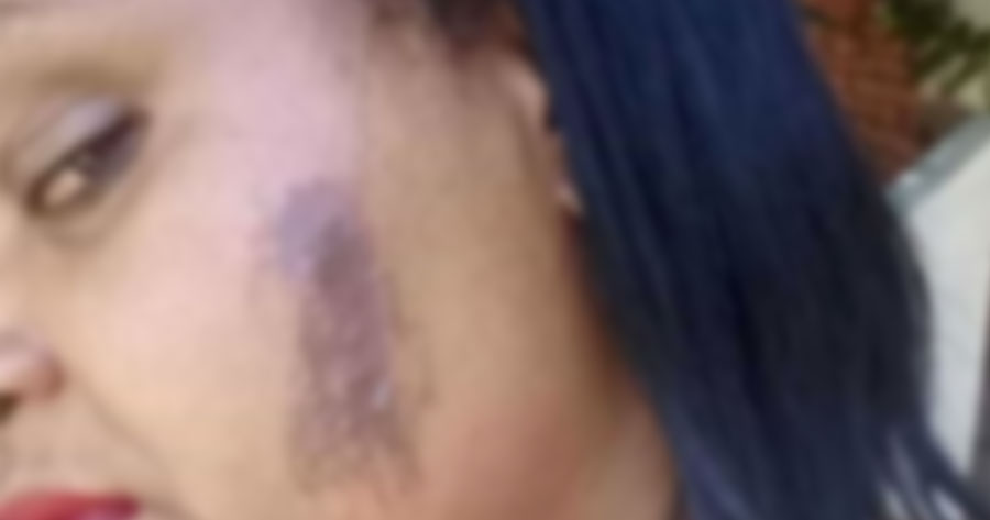 Trabalhando, mulher é torturada e tem partes do corpo cortadas durante assalto