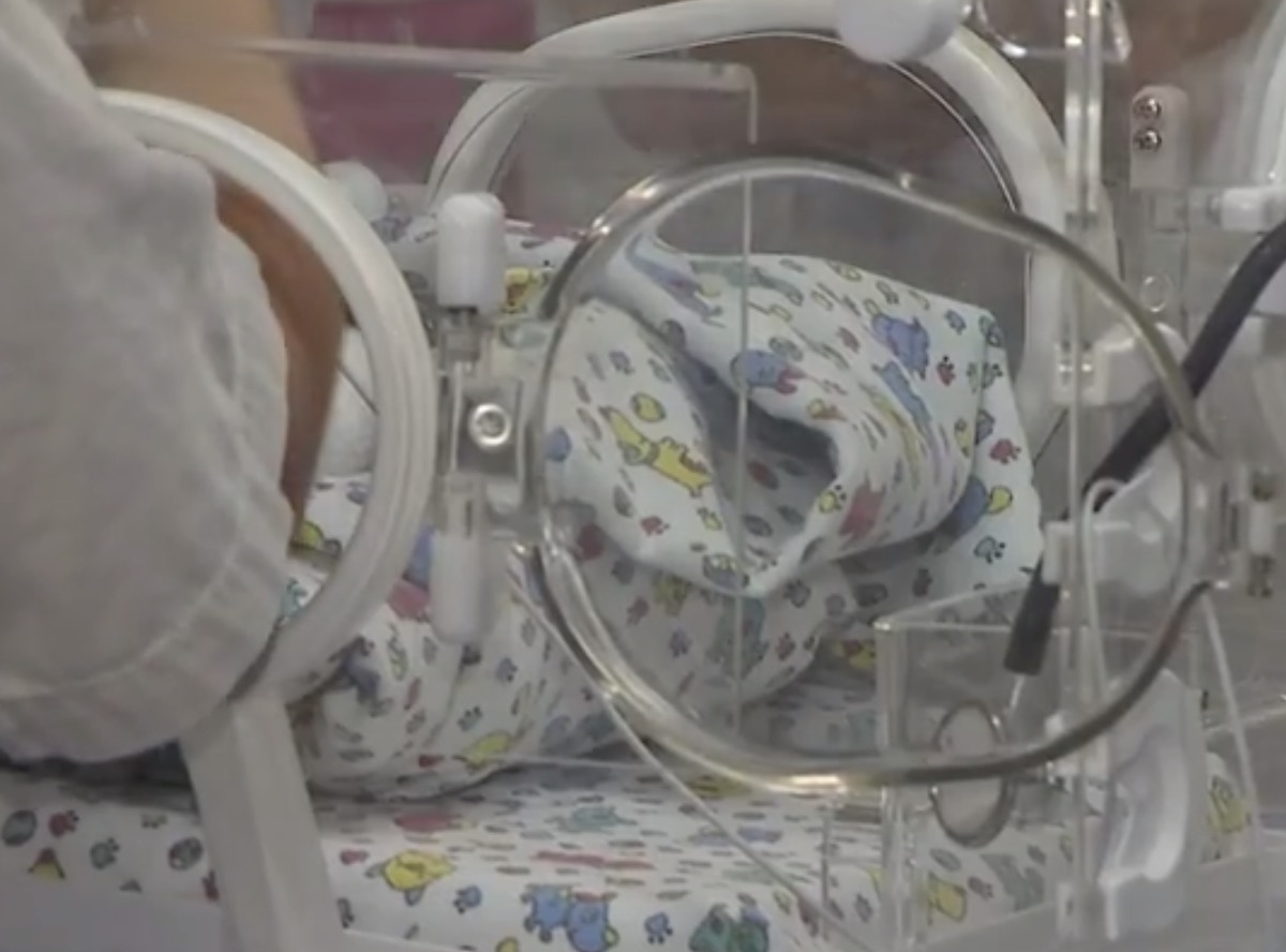 Bebê vai parar em UTI após receber leite materno na veia