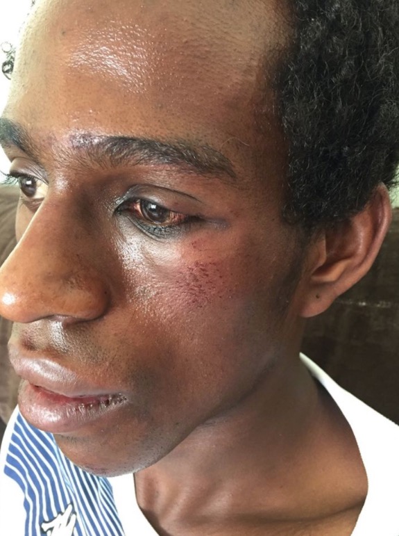 Ator é espancado após seguranças negarem ajuda contra bandidos