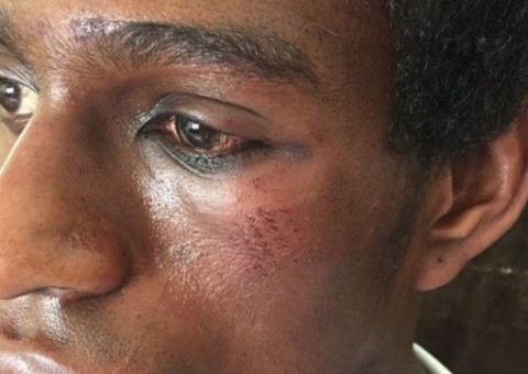 Ator é espancado após seguranças negarem ajuda contra bandidos