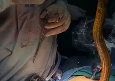 Homem vai parar no hospital com enguia enfiado no próprio ânus