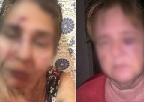 Briga entre vizinhos de prédio termina com três mulheres espancadas