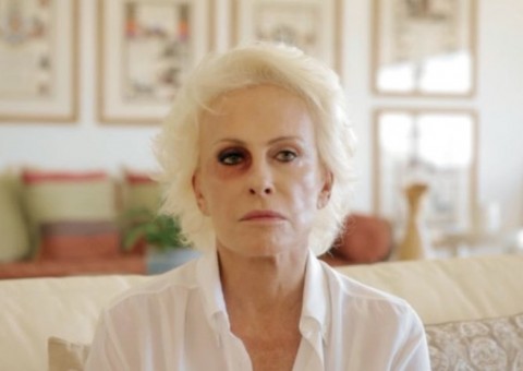 Ana Maria Braga se pronuncia sobre olho roxo e polêmica de agressão