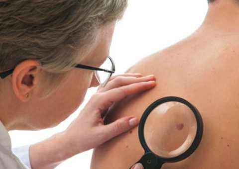 Mutirão oferece 700 consultas dermatológicas gratuitas em Manaus