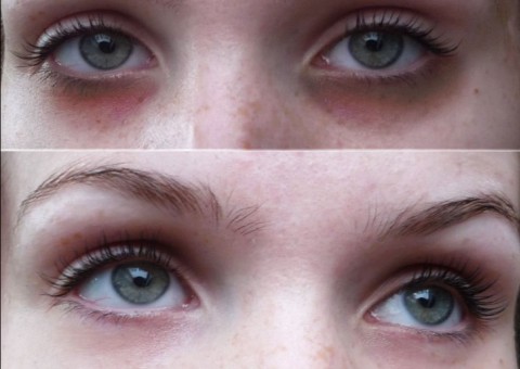 Conheça receitas e exercícios que vão ajudar a eliminar as olheiras naturalmente