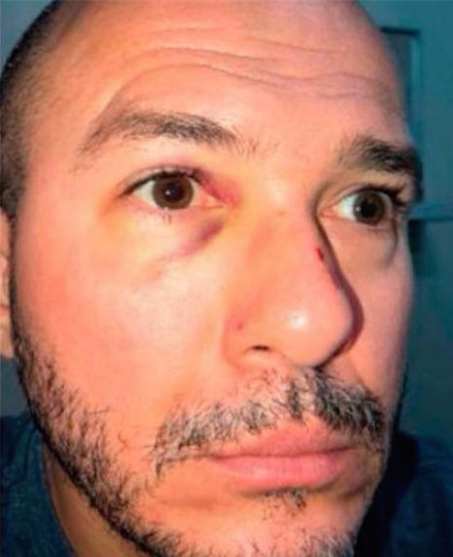 Delegado preso diz que está com dor e pede saída para ir ao médico