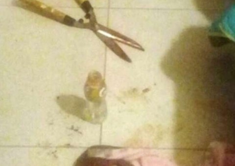 Jovem corta pênis e testículos de amante durante o sexo