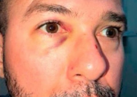 Justiça nega pedido de saída de delegado que matou advogado para atendimento médico