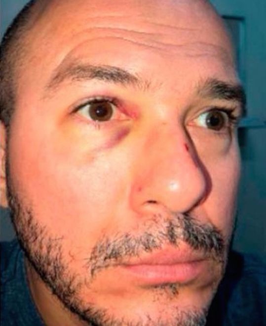 Justiça nega pedido de saída de delegado que matou advogado para atendimento médico