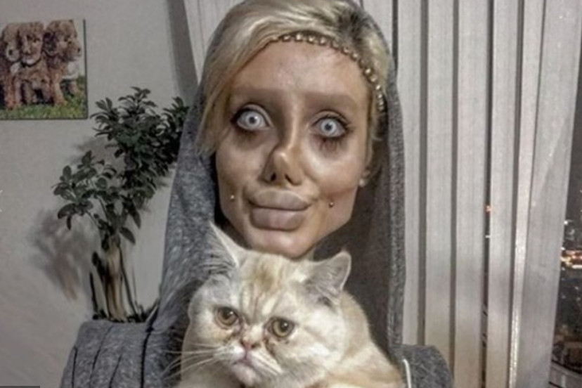 Mulher faz 50 cirurgias para ficar parecida com Angelina Jolie