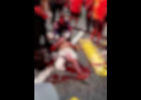 Vídeo chocante mostra homem com perna dilacerada após acidente em Manaus