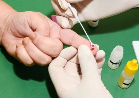 Governo estima que 136 mil pessoas não sabem que têm HIV no Brasil