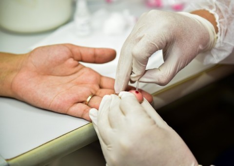 Manaus é a 4ª capital com mais casos de HIV no país