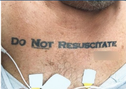 Homem com tatuagem ‘não ressuscite’ chega inconsciente a hospital e deixa médicos em dúvida
