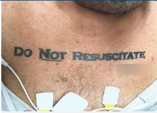 Homem com tatuagem ‘não ressuscite’ chega inconsciente a hospital e deixa médicos em dúvida