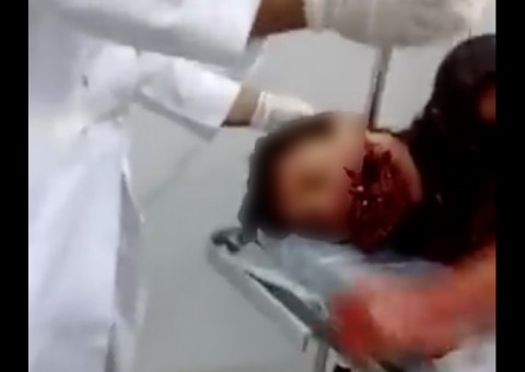 Jovem tem rosto esfacelado e morre após celular explodir durante ligação 