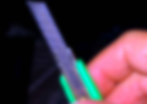 Mulher 'serra' pênis de marido e corta virilha com estilete por motivo misterioso