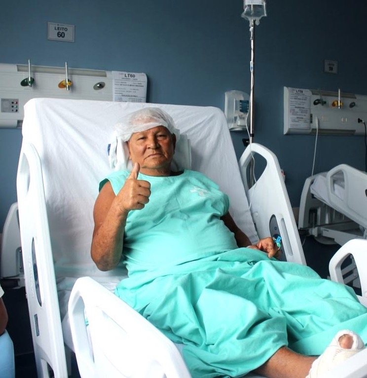 HPS da Zona Norte realiza cirurgias de câncer de pele