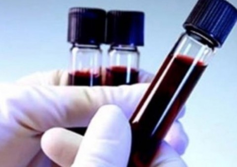 TCE suspende contrato suspeito do governo de David Almeida