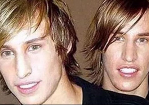 Gêmeos gastam fortuna para ficarem parecidos com Brad Pitt   