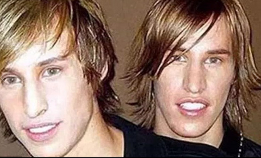 Gêmeos gastam fortuna para ficarem parecidos com Brad Pitt   