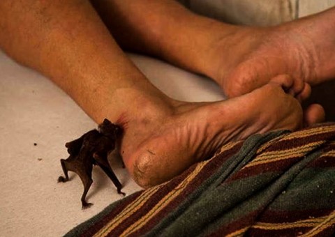 Ministério da Saúde determina imunização imediata contra raiva humana no Amazonas 