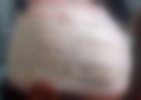 Homem é preso após tentar matar vizinho deficiente com marteladas