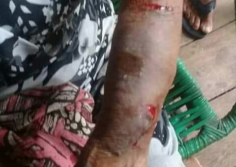 Idosa de 84 anos é espancada pelo próprio neto no Amazonas