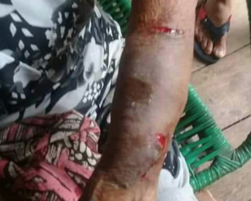 Idosa de 84 anos é espancada pelo próprio neto no Amazonas