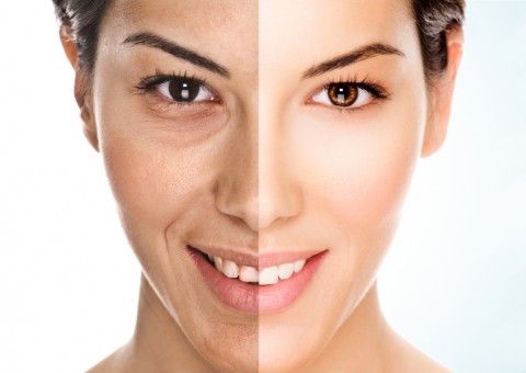 Manchas na pele? Elimine de vez com receita feita em casa