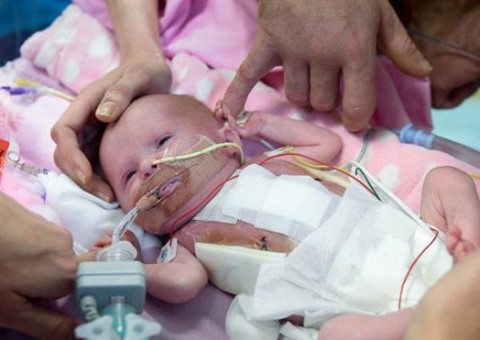 Bebê nasce com coração fora do corpo e surpreende médicos