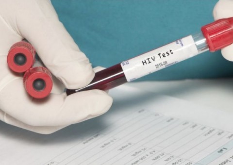 Tropical contará com laboratório exclusivo para desenvolvimento de pesquisas sobre HIV