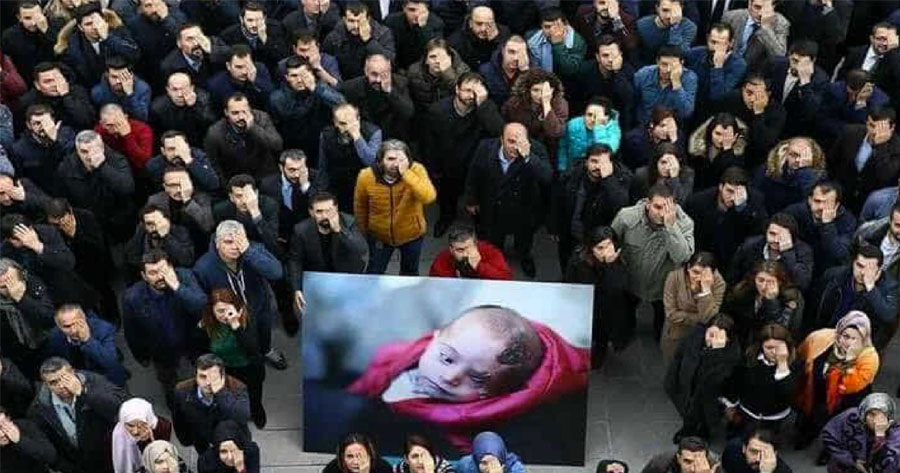 Recém-nascido perde olho em bombardeio e foto chocante comove internautas