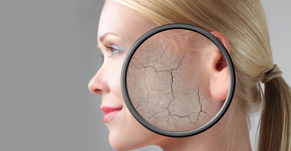 Açúcar pode afetar pele do seu rosto de 7 maneiras. Conheça os sinais